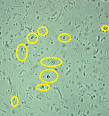 クリアランス 細菌性下痢 ペットから